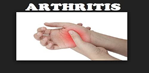 Arthritis