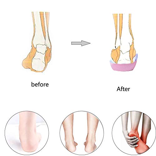 PCSsole 3/4 Plantillas de calzado ortopédico Soportes de arco alto Plantillas de zapatos para la fascitis plantar,Pie plano, Sobre-pronación,Alivio del dolor del talón(S:EU-(35-37))