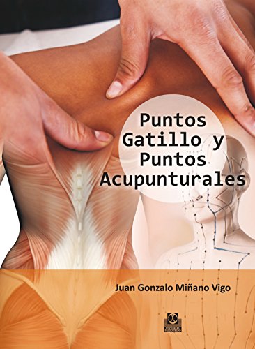 Puntos gatillo y puntos acupunturales (Color) (Medicina)