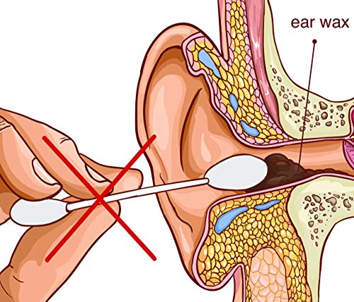 Remos - Asa auricular - Acero inoxidable - 8 cm Para eliminar el cerumen - satén