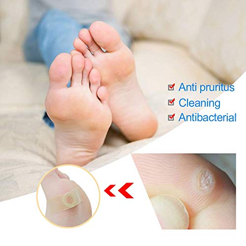 Wart Remover, Verrugas, Tratamiento Anti Verrugas Tratamiento para Quitar Verrugas Comunes y Plantares, Congela las Verrugas de Raíz, Wart Remover para Pies y Manos