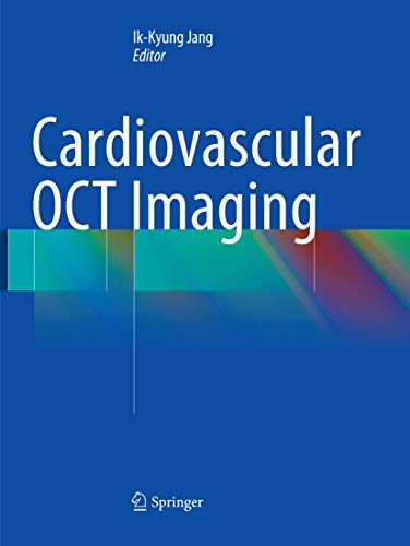 Cardiovascular OCT Imaging