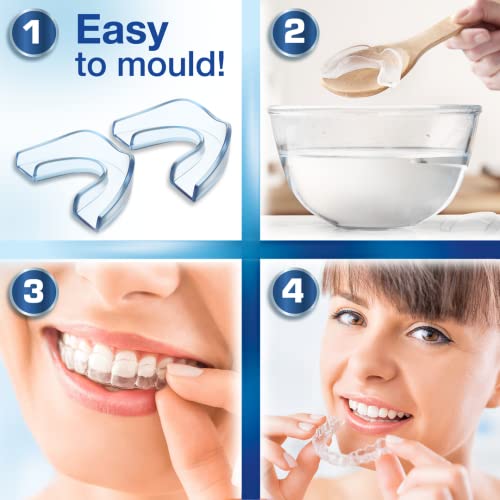 Ferula dental para bruxismo (4 x Grande), 100% libre de BPA, Tecnología de fácil moldeado, Protectores dentales, Protector dental para evitar el rechinamiento, Protector Bucal para Dormir