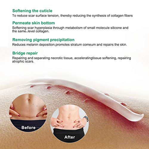 Aliver Crema de Eliminación de Cicatrices, Removedor de Estrías, Eliminación de Cicatrices de Acné Facial o Corporal, Tratamiento ee Cicatrices para Cortes, Cirugía, Quemaduras, Cortes, Queloides