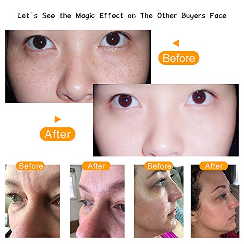 Alta Frecuencia Facial Dispositivos, 7pcs portátil alta frecuencia piel la racionalización Acne Spot Arrugas Remover hinchadas Ojos, Cuidado corporal, Belleza Facial Masaje dispositivo.