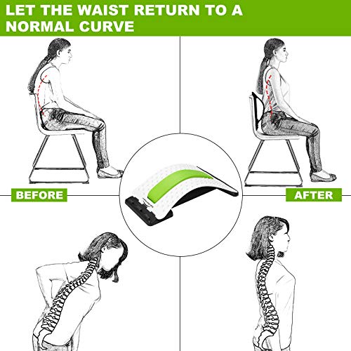 Dispositivo de estiramiento de espalda CareforYou: alivia el dolor de espalda inferior y superior, dispositivo de estiramiento lumbar, corrector de postura(blanco / verde)