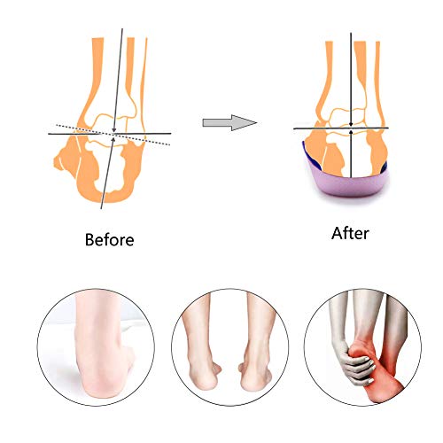 PCSsole 3/4 Plantillas de calzado ortopédico Soportes de arco alto Plantillas de zapatos para la fascitis plantar,Pie plano, Sobre-pronación,Alivio del dolor del talón (EU-(38-42))