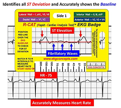 R-CAT Insignia EKG