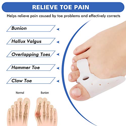 Separador de dedos del pie de Gel de Silicona Corrector de Juanetes para dedos de Martillo, Hallux Valgus, Bunion Corrección Protector con Antideslizantes, Transpirables, Suaves - 2 Pares