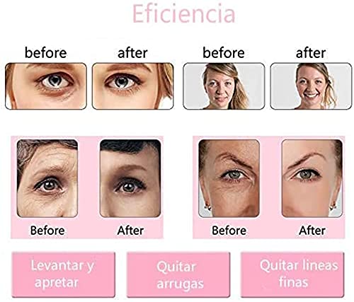 5-en-1 de alta frecuencia maquina de cuidado de la piel Máquina de alta frecuencia Portátil Piel Tighting Acne Spot Arrugas (Modo1)