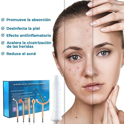 Alta Frecuencia Facial - Máquina Profesional - Elimina Arrugas, Acné y Alopecia - 5 Electrodos - Microdermoabrasión - Luz LED - Microsonic Device - Estimulación - Belleza - High Frequency Wand