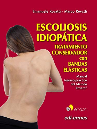 Escoliosis idiopática. Tratamiento conservador con bandas elásticas (n/a)