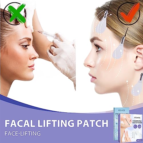 Hilos Tensores Faciales 180pcs Hilo Tensor Facial Invisible Hilos Tensores Faciales Reabsorbentes Tensores Face Tape Parches Efecto Lifting Hilo Tensor Facial Invisible Hilo De Seda De Colágeno