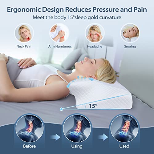 HOMCA Almohada Cervical de Espuma Viscoelastica, Almohada Ortopedica para Soporte de Cuello, Almohadas Ergonómico para Dormir de Lado y Boca Arriba